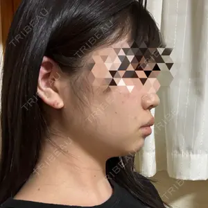 藤・ナチュレ美容クリニック 銀座院口コミ
