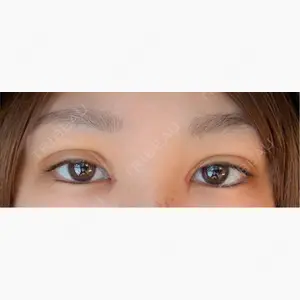 HAAB×DREAM BEAUTY CLINIC 東京本院口コミ
