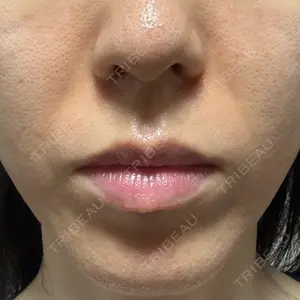 ルラ美容クリニック 静岡院口コミ