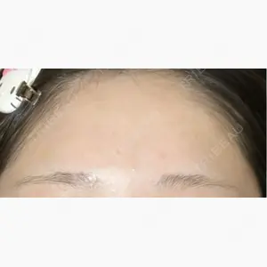ルラ美容クリニック 高崎院口コミ