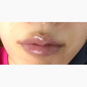ルラ美容クリニック 千葉院 / ルラスキンクリニック 千葉院口コミ