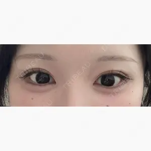 HAAB×DREAM BEAUTY CLINIC 東京本院口コミ