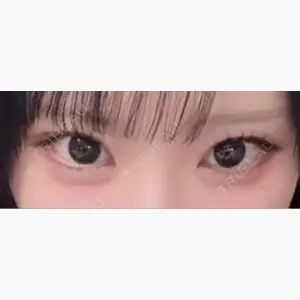 HAAB×DREAM BEAUTY CLINIC 東京本院口コミ