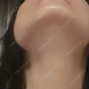 Tokyo Tensei Clinic 新宿院口コミ