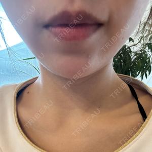フォンタナクリニック天神口コミ