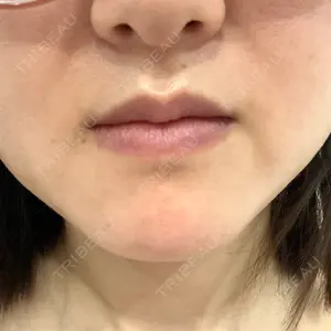BAO CLINIC 福岡博多院口コミ