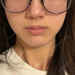 イデア美容皮膚科クリニック 柏院口コミ
