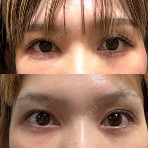 eクリニック 福岡院口コミ