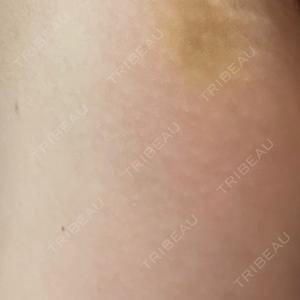 MIO CLINIC 梅田院口コミ