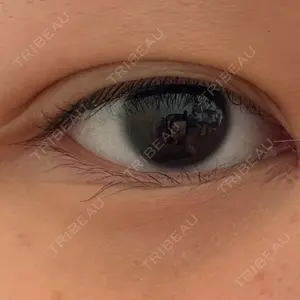 R Beauty CLINIC 銀座院口コミ