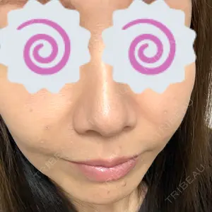 TCB東京中央美容外科 広島院口コミ