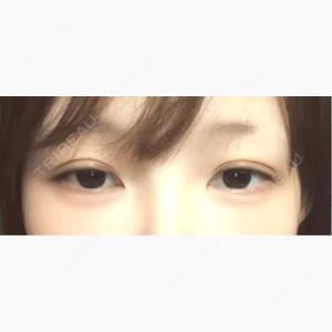 ネビュラクリニック 広島院口コミ