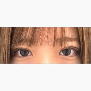 東京シンデレラ美容外科 池袋院口コミ