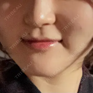 R Beauty CLINIC 銀座院口コミ