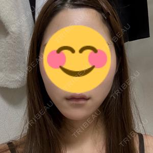オアシス美容外科口コミ