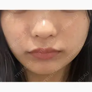 名古屋美容外科口コミ