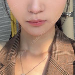 HAAB CLINIC 福岡院口コミ