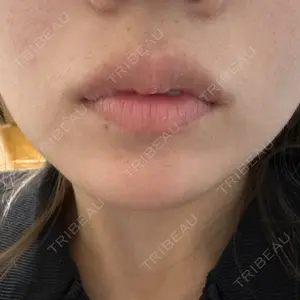 TCB東京中央美容外科 藤沢院口コミ