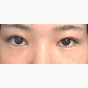 AI Beauty Clinic （エーアイ美容クリニック）口コミ
