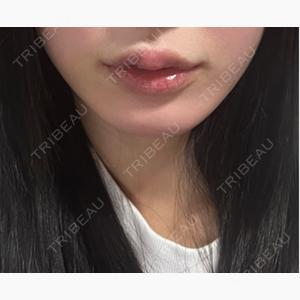ヴァージンクリニック 京都院口コミ