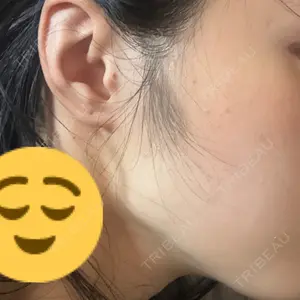 名古屋美容外科口コミ