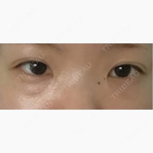 HAAB×DREAM BEAUTY CLINIC 大阪梅田院口コミ