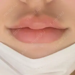 名古屋美容外科口コミ