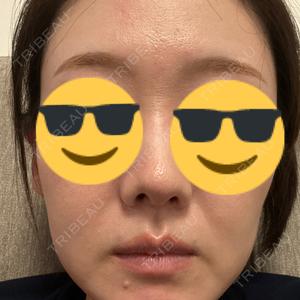 新宿TAクリニック口コミ