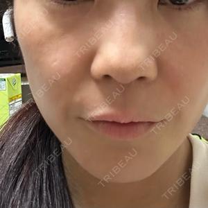 Wi Clinic （ウィ クリニック）心斎橋院口コミ