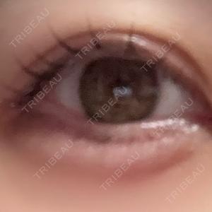 大美会クリニック 梅田院口コミ