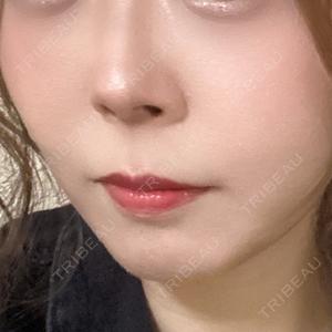 札幌美容外科ネビュラクリニック口コミ