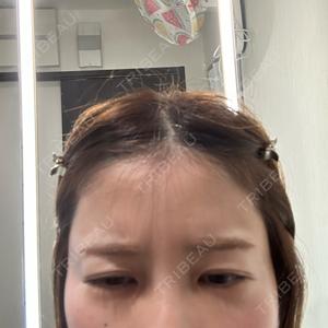 TCB東京中央美容外科 姫路院口コミ