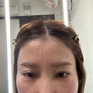 TCB東京中央美容外科 姫路院口コミ