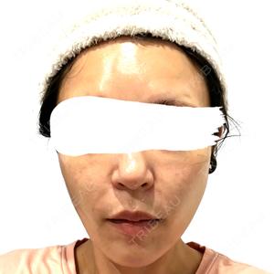 Tokyo Tensei Clinic 大阪梅田院口コミ