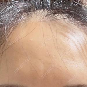 PRO CLINIC プロクリニック 銀座院口コミ
