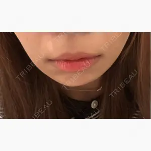 HAAB×DREAM BEAUTY CLINIC 東京本院口コミ