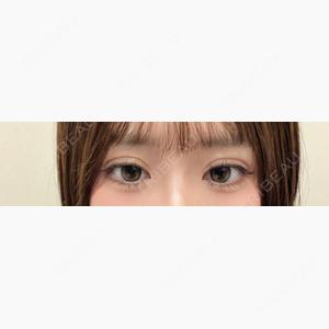 アリエル美容クリニック 水戸院口コミ