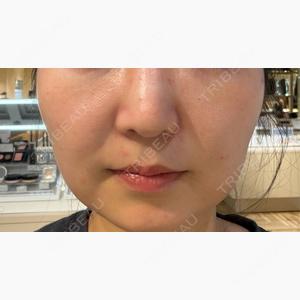 ライズワン美容皮膚科クリニック口コミ