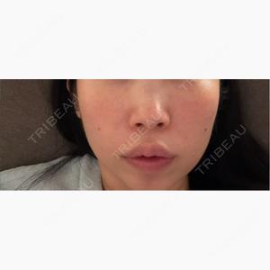 Wing clinic 豊中駅前院口コミ