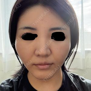EMMA CLINIC（エマクリニック）口コミ