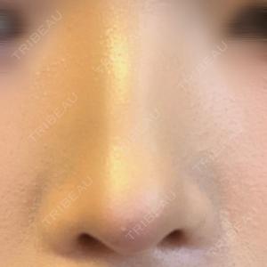 HAAB×DREAM BEAUTY CLINIC 大阪梅田院口コミ
