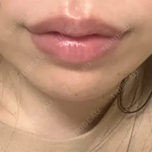 ルラ美容クリニック 大阪本院口コミ
