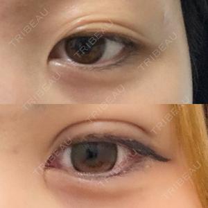 東京シンデレラ美容外科 大宮院口コミ