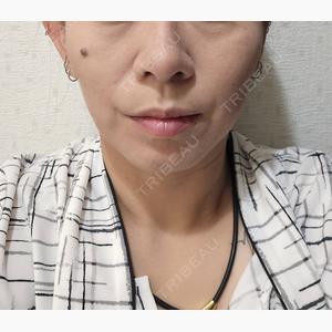東京形成美容外科 船橋院口コミ