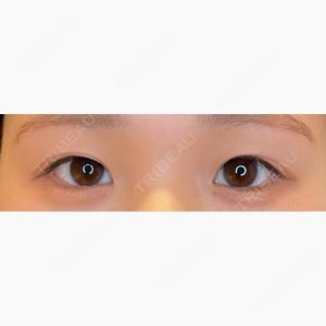 LOUIS CLINIC 二子玉川院【ルイクリニック】口コミ