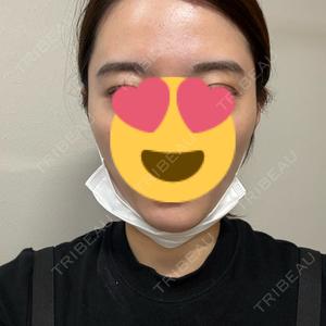 ウィルビークリニック 新宿院口コミ