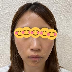 銀座TSUBAKIクリニック口コミ