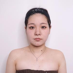 アリエル美容クリニック 水戸院口コミ