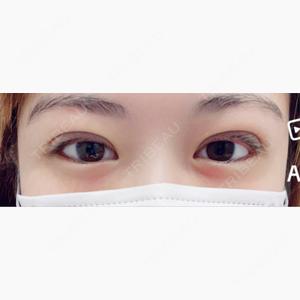 R Beauty CLINIC 名古屋院口コミ