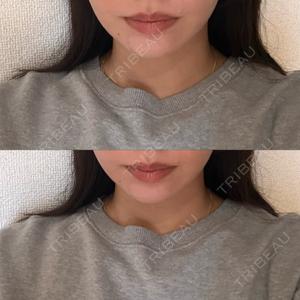 湘南美容クリニック 新橋銀座口院口コミ